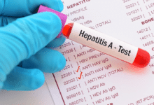 Advierten por brote de hepatitis tipo ‘A’