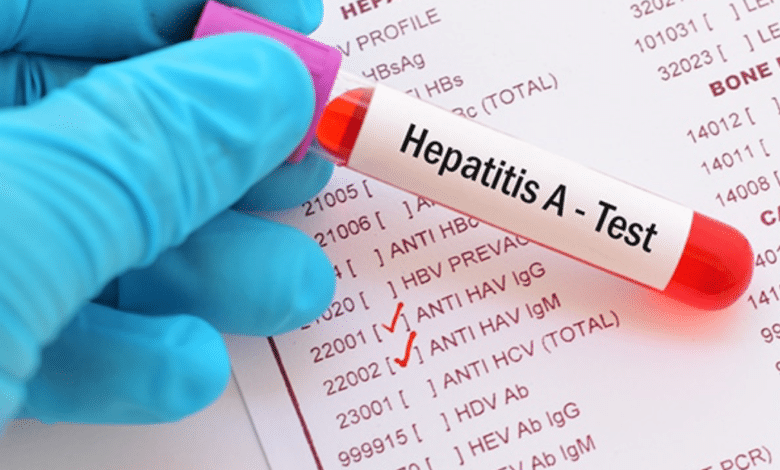 Advierten por brote de hepatitis tipo ‘A’