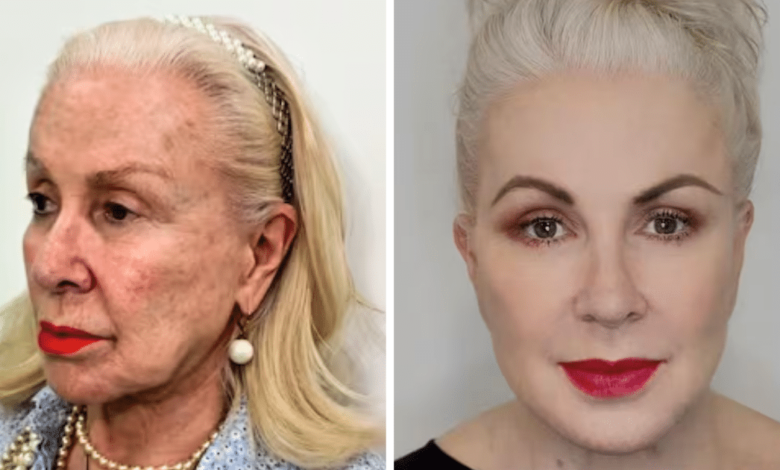 Laura Zapata luce nuevo rostro a los 68 años y se defiende de los haters