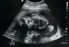 Chiapas aprueba ley que garantiza aborto legal a menores víctimas de violación