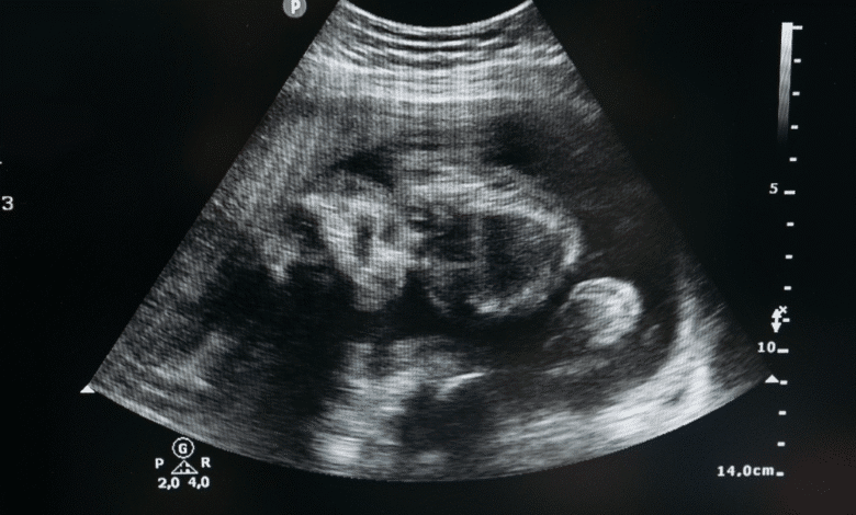 Chiapas aprueba ley que garantiza aborto legal a menores víctimas de violación