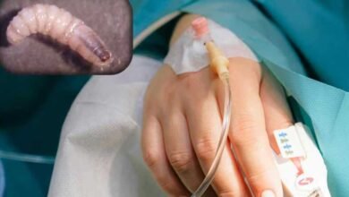 Alertan por nuevos casos de miasis en Chiapas