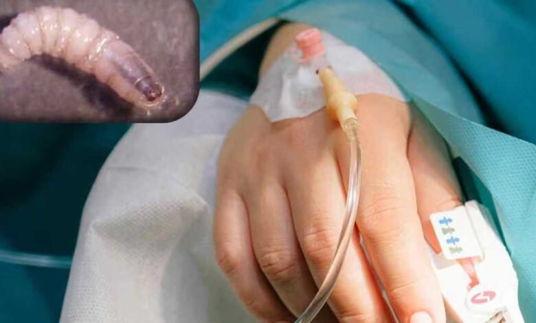 Alertan por nuevos casos de miasis en Chiapas