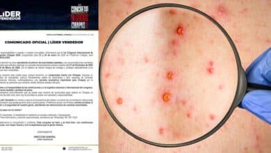 Por sarampión suspenden el 1er Congreso Internacional de Negocios Chiapas