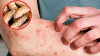 Chiapas registra más casos de miasis en la última semana