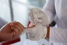 Hepatitis una enfermedad silenciosa que aún representa un desafío para la salud en Chiapas