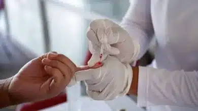 Hepatitis una enfermedad silenciosa que aún representa un desafío para la salud en Chiapas