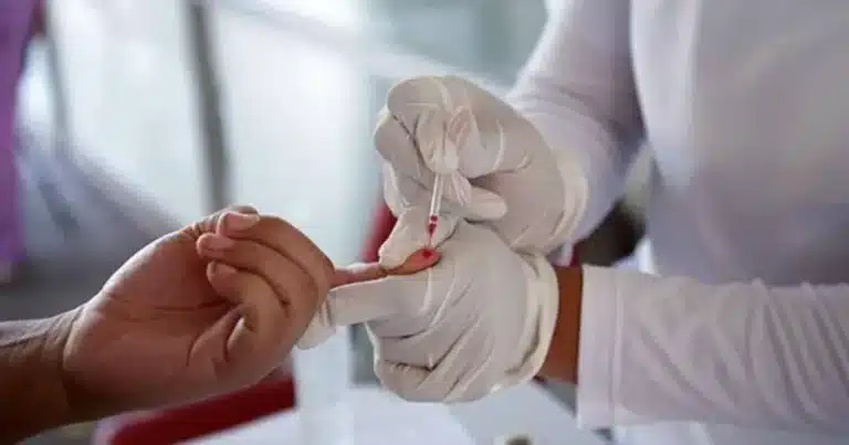 Hepatitis una enfermedad silenciosa que aún representa un desafío para la salud en Chiapas
