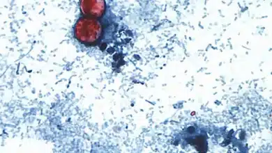 estados unidos confirma dos muertes por brote de ciclosporiasis asociado al parásito cyclospora