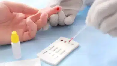 Municipios de Chiapas recibirán servicios médicos y pruebas de VIH